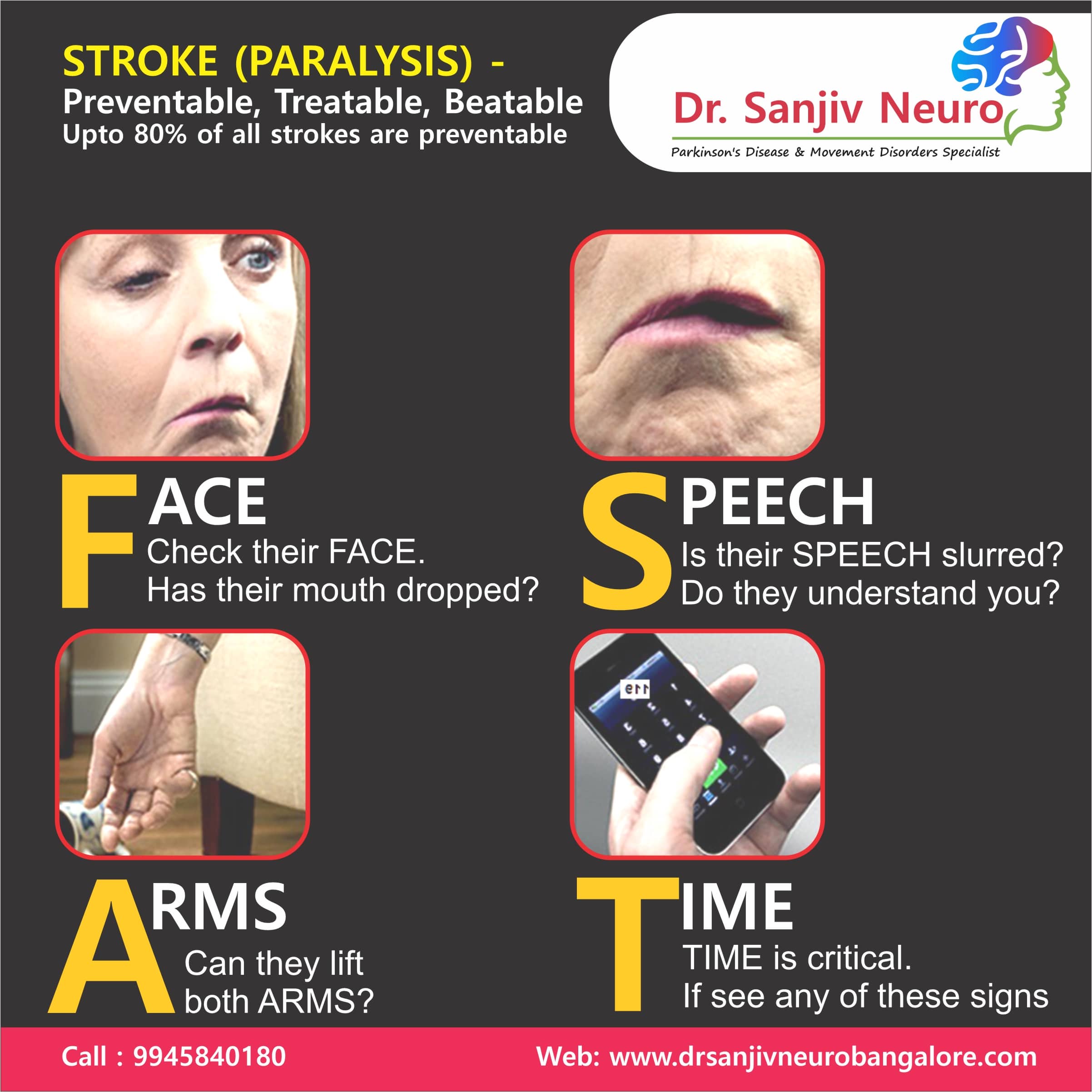 stroke paralysis